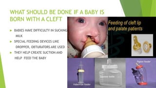 common oral disease and condition | PPTX