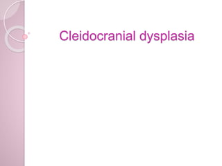 Cleidocranial dysplasia
 