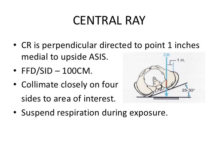 Clement Nakayama Method