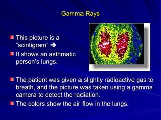 Gamma Rays
Gamma Rays
This picture is a
This picture is a
“scintigram”
“scintigram” 

It shows an asthmatic
It shows an asthmatic
person’s lungs.
person’s lungs.
The patient was given a slightly radioactive gas to
The patient was given a slightly radioactive gas to
breath, and the picture was taken using a gamma
breath, and the picture was taken using a gamma
camera to detect the radiation.
camera to detect the radiation.
The colors show the air flow in the lungs.
The colors show the air flow in the lungs.
 