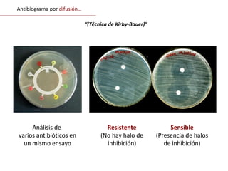 Resistente
(No hay halo de
inhibición)
Análisis de
varios antibióticos en
un mismo ensayo
Sensible
(Presencia de halos
de inhibición)
Antibiograma por difusión…
“(Técnica de Kirby-Bauer)”
 