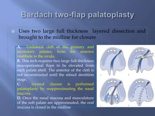 Clet lip and palate | PPTX
