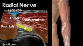 Cleveland Clinic cadaver course brachial plexus | PDF