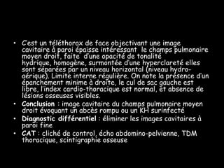• C’est un téléthorax de face objectivant une image
cavitaire à paroi épaisse intéressant le champs pulmonaire
moyen droit, faite d’une opacité de tonalité
hydrique, homogène, surmontée d’une hyperclareté elles
sont séparées par un niveau horizontal (niveau hydroaérique). Limite interne régulière. On note la présence d’un
épanchement minime à droite, le cul de sac gauche est
libre, l’index cardio-thoracique est normal, et absence de
lésions osseuses visibles.
• Conclusion : image cavitaire du champs pulmonaire moyen
droit évoquant un abcès rompu ou un KH surinfecté
• Diagnostic différentiel : éliminer les images cavitaires à
paroi fine
• CAT : cliché de control, écho abdomino-pelvienne, TDM
thoracique, scintigraphie osseuse

 