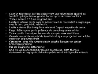 •
•
•
•
•
•
•
•
•
•

C’est un téléthorax de face objectivant une volumineuse opacité de
tonalité hydrique hilaire gauche Forme : grossièrement ovalaire
Taille : mesure 6 à 8 cm de grand axe
Limites : interne noyée dans le médiastin et se raccordant à angle aigue
avec le bord gauche du médiastin.
Limite externe flou irrégulière réalisant l’aspect en patte de crabe
Plage : hétérogène par la présence de broncho gramme aérien
Index cardio thoracique, les culs de sacs pleuraux sont libres
On note une petite opacité de tonalité calcique se projetant sur le lobe
supérieur du poumon droit
Conclusion : gros hile tumorale malin gauche évoquant un cancer
bronchique proximal
Pas de diagnostic différentiel
CAT : bilan d’extension:fibroscopie bronchique, TDM thoracoabdominale, échographie abdomino-pelvienne et scintigraphie osseuse

 