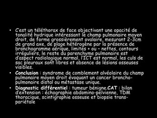 • C’est un téléthorax de face objectivant une opacité de
tonalité hydrique intéressant le champ pulmonaire moyen
droit, de forme grossièrement ovalaire, mesurant 2-3cm
de grand axe, de plage hétérogène par la présence de
bronchogramme aérique, limites + ou – nettes, contours
irréguliers, le reste du parenchyme pulmonaire est
d’aspect radiologique normal, l’ICT est normal, les culs de
sac pleuraux sont libres et absence de lésions osseuses
visibles.
• Conclusion : syndrome de comblement alvéolaire du champ
pulmonaire moyen droit évoquant un cancer bronchopulmonaire distal ou métastase unique.
• Diagnostic différentiel : tumeur bénigne.CAT : bilan
d’extension : échographie abdomino-pelvienne, TDM
thoracique, scintigraphie osseuse et biopsie transpariétale

 