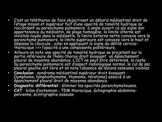 •

•

•
•
•

C’est un téléthorax de face objectivant un débord médiastinal droit de
l’étage moyen et supérieur fait d’une opacité de tonalité hydrique se
raccordant au parenchyme pulmonaire à angle ouvert ce qui signe son
appartenance au médiastin, de plage homogène, la limite interne est
invisible noyée dans le médiastin, la limite externe nette convexe vers le
parenchyme pulmonaire, la limite supérieure est convexe vers le haut et
dépasse la clavicule ; ainsi en appliquant le signe du défilé cervicothoracique ==> l’opacité a une composante postérieure.
Ailleurs on note une opacité de tonalité hydrique se projetant sur la
partie inférieure de l’hémi-thorax droit évoquant un épanchement
pleural de moyenne abondance. L’ICT ne peut être déterminé, le reste
du parenchyme pulmonaire est d’aspect radiologique normal, le cul de sac
pleural gauche est libre et on note l’absence de lésions osseuses visibles.
Conclusion : syndrome médiastinal supérieur droit évoquant
(lymphome, lymphothymome, thymome, tératome) associé à un
épanchement pleural droit de moyenne abondance.
Diagnostic différentiel : éliminer les opacités parenchymateuses.
CAT : bilan d’extension ; TDM thoracique, échographie abdominopelvienne, scintigraphie osseuse

 