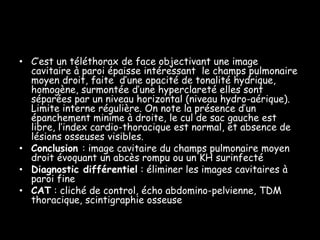 • C’est un téléthorax de face objectivant une image
  cavitaire à paroi épaisse intéressant le champs pulmonaire
  moyen droit, faite d’une opacité de tonalité hydrique,
  homogène, surmontée d’une hyperclareté elles sont
  séparées par un niveau horizontal (niveau hydro-aérique).
  Limite interne régulière. On note la présence d’un
  épanchement minime à droite, le cul de sac gauche est
  libre, l’index cardio-thoracique est normal, et absence de
  lésions osseuses visibles.
• Conclusion : image cavitaire du champs pulmonaire moyen
  droit évoquant un abcès rompu ou un KH surinfecté
• Diagnostic différentiel : éliminer les images cavitaires à
  paroi fine
• CAT : cliché de control, écho abdomino-pelvienne, TDM
  thoracique, scintigraphie osseuse
 