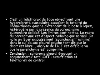 • C’est un téléthorax de face objectivant une
  hyperclareté avasculaire occupant la totalité de
  l’hémi-thorax gauche d’étendant de la base à l’apex,
  hétérogène par la présence du parenchyme
  pulmonaire collabé. Les limites sont nettes. Le reste
  du parenchyme est d’aspect radiologique normal. On
  note un léger émoussement (épanchement minime)
  dans le cul de sac pleural gauche tant dis que le
  droit est libre. L’analyse de l’ICT est difficile vu
  que le parenchyme est comprimé.
• Conclusion : syndrome pleural évoquant un
  pneumothorax total CAT : exsufflation et
  téléthorax de control
 