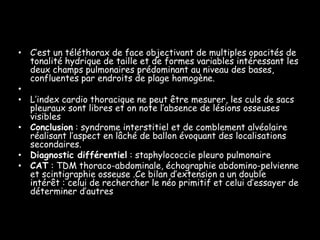 • C’est un téléthorax de face objectivant de multiples opacités de
  tonalité hydrique de taille et de formes variables intéressant les
  deux champs pulmonaires prédominant au niveau des bases,
  confluentes par endroits de plage homogène.
•
• L’index cardio thoracique ne peut être mesurer, les culs de sacs
  pleuraux sont libres et on note l’absence de lésions osseuses
  visibles
• Conclusion : syndrome interstitiel et de comblement alvéolaire
  réalisant l’aspect en lâché de ballon évoquant des localisations
  secondaires.
• Diagnostic différentiel : staphylococcie pleuro pulmonaire
• CAT : TDM thoraco-abdominale, échographie abdomino-pelvienne
  et scintigraphie osseuse .Ce bilan d’extension a un double
  intérêt : celui de rechercher le néo primitif et celui d’essayer de
  déterminer d’autres atteintes
 