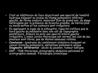 • C’est un téléthorax de face objectivant une opacité de tonalité
  hydrique siégeant au niveau du champ pulmonaire inférieur
  gauche, de forme ovalaire, mesurant 5cm de grand axe, de plage
  hétérogène par la présence de broncho gramme, de limites plus
  ou moins nettes et les contours sont irréguliers.
• En appliquant le signe de la silhouette, l’opacité n’efface pas le
  bord gauche du médiastin donc elle est de topographie
  postérieure. Ailleurs on note une opacité hilaire gauche
  irrégulière. L’index cardio-thoracique est normal, les culs de sac
  pleuraux sont libres, pas de lésions osseuses visibles.
• Conclusion : syndrome de comblement alvéolaire évoquant un
  cancer broncho-pulmonaire, métastase pulmonaire unique
  Diagnostic différentiel : abcès du poumon, tumeur bénigne.
• CAT : TDM thoracique, échographie abdomino-pelvienne et
  scintigraphie osseuse Fibroscopie bronchique
 