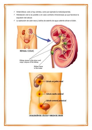  Antieméticos: solo si hay vómitos, como por ejemplo la metoclopramida.
 Hidratación oral si es posible o en caso contrario intravenosas ya que favorece la
expulsión del cálculo
 La aplicación de calor seco y baños de asiento de agua caliente alivian el dolor.
 