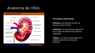 Cólico nefrítico o cólico reno-ureteral (1).pptx