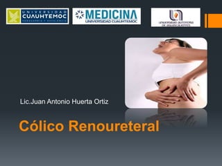 Cólico Renoureteral
Lic.Juan Antonio Huerta Ortiz
 