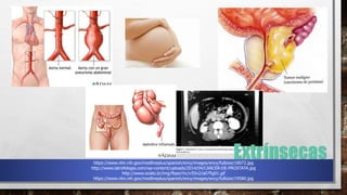 https://www.nlm.nih.gov/medlineplus/spanish/ency/images/ency/fullsize/18072.jpg
http://www.latrofologia.com/wp-content/uploads/2014/04/CANCER-DE-PROSTATA.jpg
http://www.scielo.br/img/fbpe/rhc/v55n2/a07fig01.gif
https://www.nlm.nih.gov/medlineplus/spanish/ency/images/ency/fullsize/19580.jpg
 