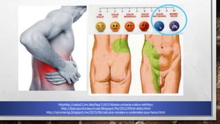 httphttp://salud.Ccm.Net/faq/11813-litiasis-urinaria-colico-nefritico
http://laacupunturaauricular.Blogspot.Mx/2012/09/el-dolor.html
http://ejromerog.blogspot.mx/2015/06/calculos-renales-y-ureterales-que-hacer.html
 