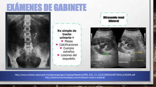 EXÁMENES DE GABINETE
Rx simple de
tracto
urinario
♥ Masas
♥ Calcificaciones
♥ Cuerpos
extraños
♥ Lesiones del
esqueleto
Ultrasonido renal
bilateral
http://www.cenetec.salud.gob.mx/descargas/gpc/CatalogoMaestro/IMSS_635_13_COLICORENOURETERAL/635GRR.pdf
http://www.cenetec.salud.gob.mx/descargas/gpc/CatalogoMaestro/IMSS_635_13_COLICORENOURETERAL/635GRR.pdf
http://bestcommunionideas.com/en/litiasis-renal-y-ureteral/
 