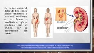 Se define como el
dolor de tipo cólico
agudo, unilateral o
bilateral localizado
en el flanco e
irradiado a ingle o
genitales, que se
origina por la
obstrucción de
uréter.
http://www.infirmus.es/wp-content/uploads/2012/10/Fotolia_38379810_colico-nefritico.jpg
http://patients.uroweb.org/fileadmin/eau_images/images_full/cz/renal-colic.jpg
 