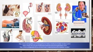 http://www.monografias.com/trabajos63/anomalias-renales/anomalias-renales2.shtml
https://www.nlm.nih.gov/medlineplus/spanish/kidneytransplantation.html
http://www.urologosalamanca.com/tecnicas-y-tratamientos/enfermedades-renales/
 