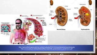 http://gesundheit.naanoo.de/wp-content/uploads/2015/10/nierenbeckenentzuendung.jpg
http://www.polo.pn.it/sites/default/files/vessichelli_presentazione_pordenone1.pdf
 