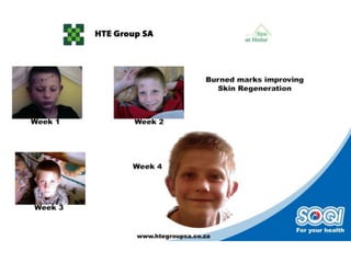 Public testimonials