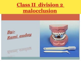 Class II division 2
malocclusion

 