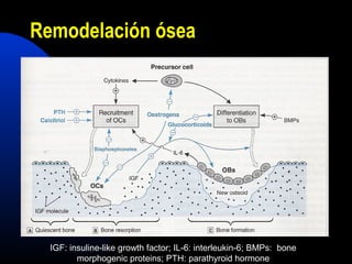 Remodelación ósea 
IGF: insuline-like growth factor; IL-6: interleukin-6; BMPs: bone 
morphogenic proteins; PTH: parathyroid hormone 
 