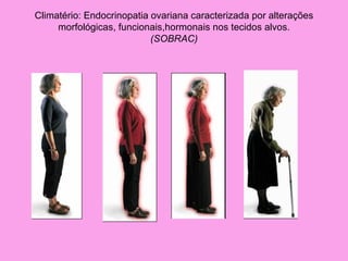 Climatério: Endocrinopatia ovariana caracterizada por alterações
     morfológicas, funcionais,hormonais nos tecidos alvos.
                           (SOBRAC)
 