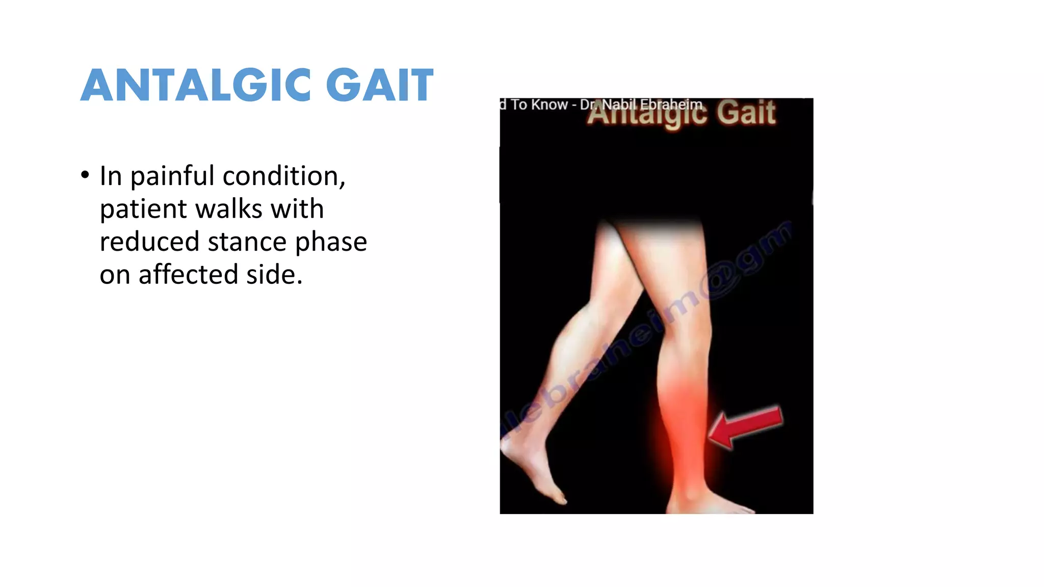 Clinical examination of hip | PPTX