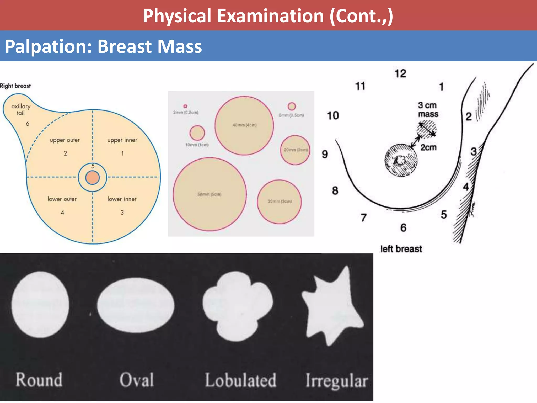 Clinical picture of breast cancer | PPTX | Cancer | Diseases and Conditions