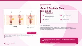 clindamycin anitbiotic clindacin_gel.pptx