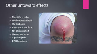 Mobillifom Rash Clindamycin | PPT