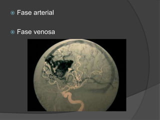    Fase arterial

   Fase venosa
 