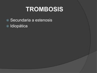 TROMBOSIS
 Secundaria a estenosis
 Idiopática
 