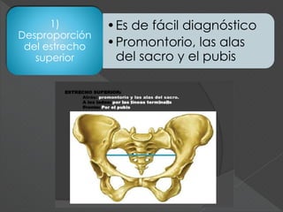 •Es de fácil diagnóstico
•Promontorio, las alas
del sacro y el pubis
1)
Desproporción
del estrecho
superior
 
