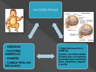FACTORES FETALES
1) Feto Macrosomico ≥
4.500 Grs
2) Fetos con hidrocefalia
3) Fetos que con lesiones
tumorales que aumentan
tórax, abdomen, hígado
y ascitis
- OBESIDAD
- FACTORES
GENÉTICOS
- DIABETES
- CABEZA FETAL NO
ENCAJADA
 