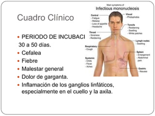 Molestia general, intranquilidad o sensación general de enfermedad.Somnolencia.Inapetencia.Rigidez o dolores musculares.Inflamación del bazo.Erupción cutánea.