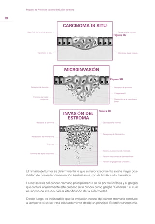 20
Programa de Prevención y Control del Cáncer de Mama
El tamaño del tumor es determinante ya que a mayor crecimiento existe mayor pos-
ibilidad de presentar diseminación (metástasis), por vía linfática y/o hemática.
La metastasis del cáncer mamario principalmente se da por vía linfática y el ganglio
que captura originalmente este proceso se le conoce como ganglio “Centinela” el cual
es motivo de estudio para la etapificación de la enfermedad.
Desde luego, es indiscutible que la evolución natural del cáncer mamario conduce
a la muerte si no se trata adecuadamente desde un principio. Existen tumores ma-
CARCINOMA IN SITU
Superficie de la célula epitelial Célula epitelial normal
Carcinoma in situ Membrana basal intacta
MICROINVASIÓN
INVASIÓN DEL
ESTROMA
Célula epitelial normal
Receptor de laminina
Receptor de laminina
Receptores de fibronectina
Receptores de fibronectina
Factores auteocrinos de motilidad
Factores vasculares de permeabilidad
Factores angiogénicos tumorales
Enzimas
Estrome del tejido
conjuntivo
Estrome del tejido conjuntivo
Disolución de la membrana
basal
Receptor de laminina
Colagenasa IV
Figura 9A
Figura 9B
Figura 9C
 