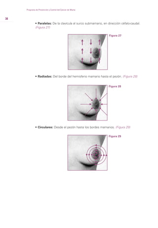 38
• Paralelas: De la clavícula al surco submamario, en dirección céfalo-caudal.
(Figura 27)
Programa de Prevención y Control del Cáncer de Mama
Figura 27
• Radiadas: Del borde del hemisferio mamario hasta el pezón. (Figura 28)
Figura 28
• Circulares: Desde el pezón hasta los bordes mamarios. (Figura 29)
Figura 29
 