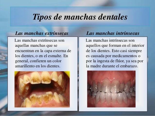 Clinica Dental Barcelona