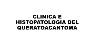 CLINICA E
HISTOPATOLOGIA DEL
QUERATOACANTOMA
 