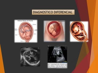 DIAGNOSTICO DIFERENCIAL
 
