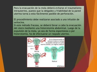 Para la evacuación de la mola deberá evitarse el traumatismo
intrauterino, puesto que la delgadez y friabilidad de la pared
uterina torna a esta fácilmente pasible de perforación.
El procedimiento debe realizarse asociado a una infusión de
oxitocina.
Si este método fracasa, se deberá llevar a cabo la evacuación
del útero mediante una histerotomía abdominal. Luego de la
expulsión de la mola, ya sea de forma espontánea o por
histerotomía, ha de efectuarse un raspado uterino.
 
