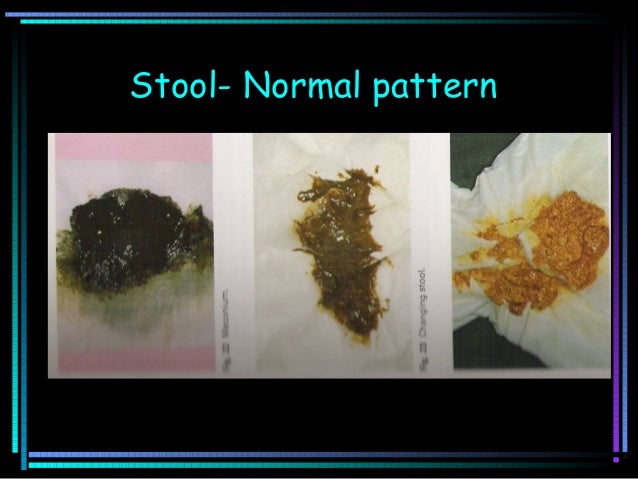 clinical monitoring of sick newborn lsd normal head circumference chart