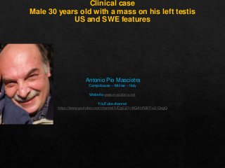 Clinical case
Male 30 years old with a mass on his left testis
US and SWE features

Antonio Pio Masciotra
Campobasso – Molise – Italy
Website www.masciotra.net
YouTube channel
https://www.youtube.com/channel/UCgCj21nKGAhR997Ia3-QegQ

 