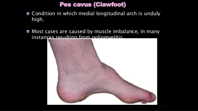 Clinical anatomy of the lower limb anatomical diagram of foot 