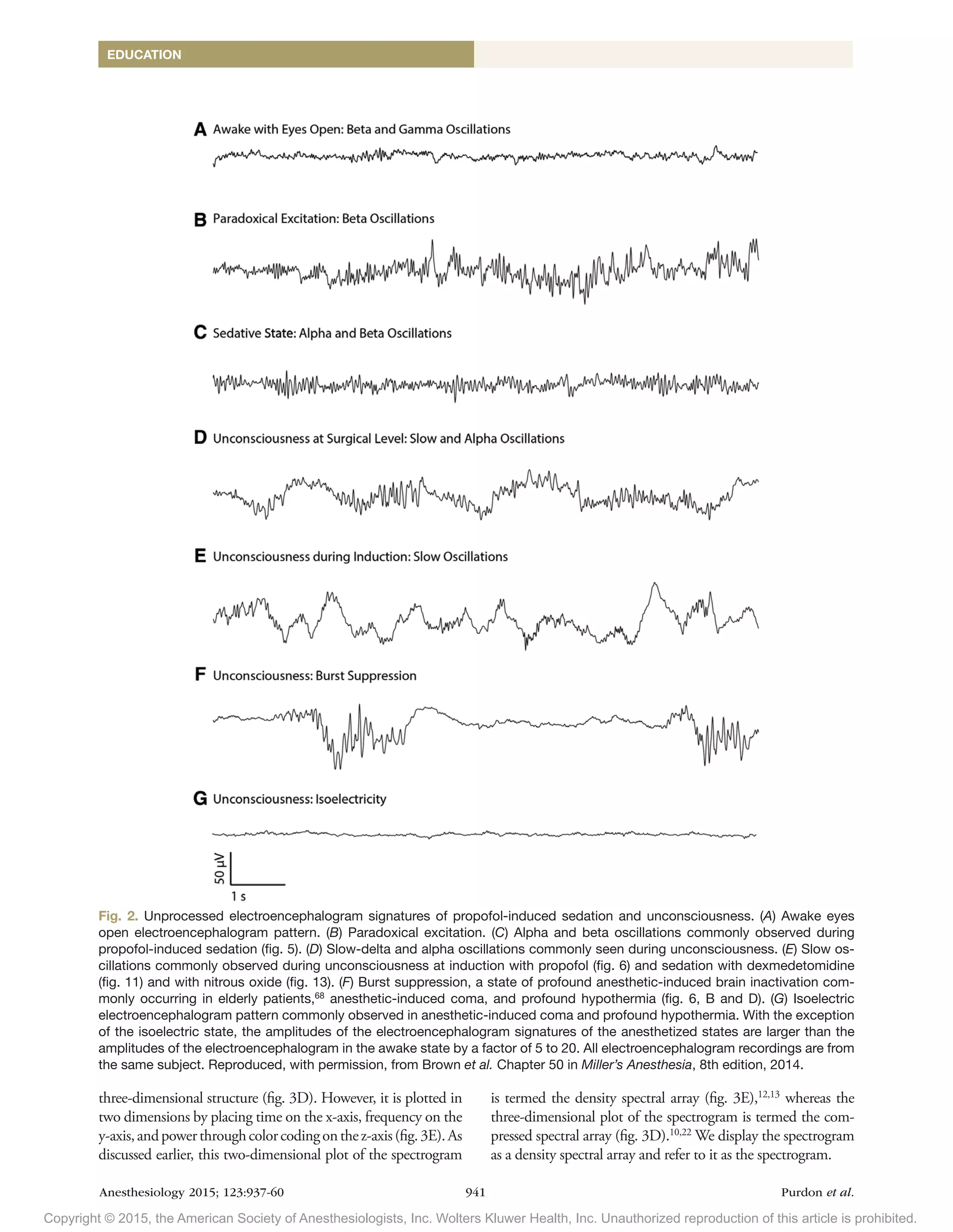 Clinical electroencephalography-for-anesthesiologists | PDF