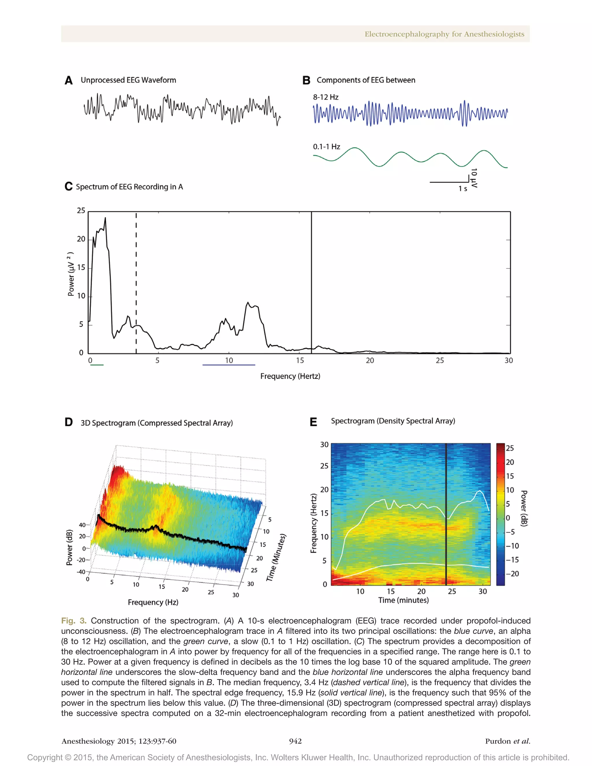 Clinical electroencephalography-for-anesthesiologists | PDF