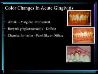 Clinical-features-of-gingivitis-Dr.-M.-Yamuna.ppt