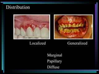 Clinical-features-of-gingivitis-Dr.-M.-Yamuna.ppt
